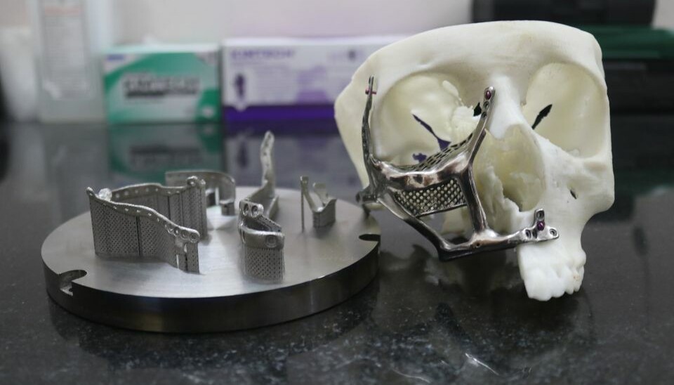 IMPLANTATER: 3D-printede implantater til ansikt og munnhule utviklet for pasienter rammet av soppinfeksjonen mukormykose. Mukormykose angriper ansiktsvevet og kan gi tap av øyne, nese, munn, og til og med hele ansiktet. (Foto: Indian Institute of Technology, Madras / ZorioX Innovation Labs)