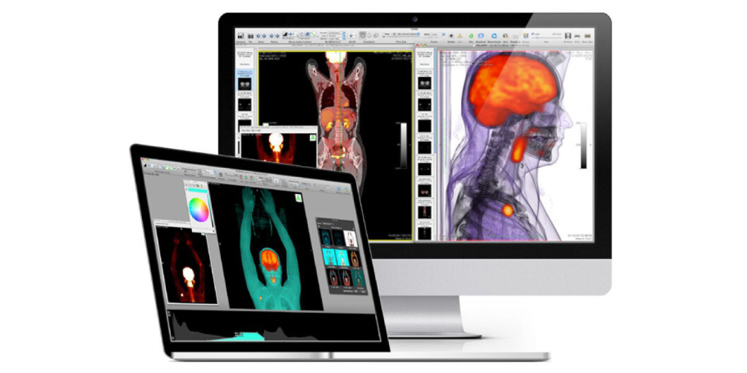 MRI: Se dine egne røntgenbilder (Foto: OsiriX) MRI: Se dine egne røntgenbilder (Foto: OsiriX)