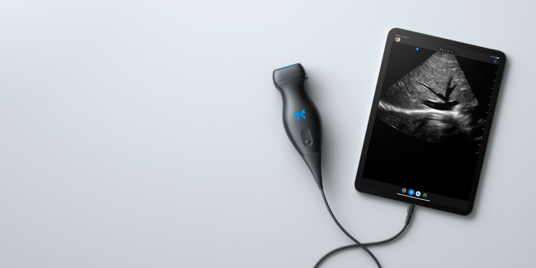 LYD: Det holder med det ene sensorhodet (Foto: Butterfly IQ) LYD: Det holder med det ene sensorhodet (Foto: Butterfly IQ)