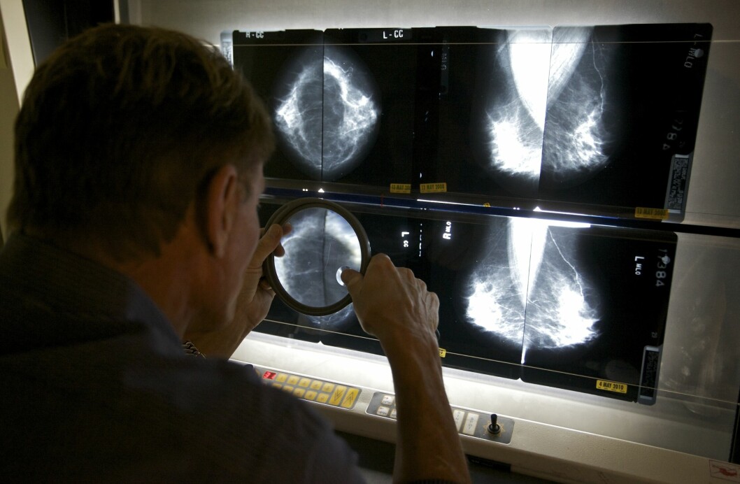 MAMMOGRAFI: En radiolog undersøker bilder tatt ved mammografi i Los Angeles i USA. (Illustrasjonsfoto: Damian Dovarganes / AP / NTB scanpix)
